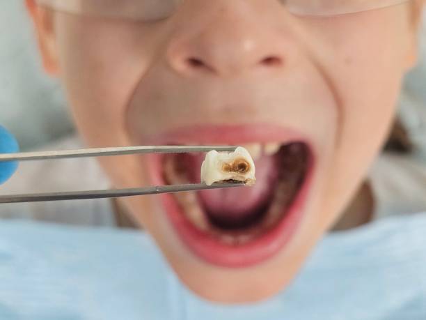 Best Emergency Treatment for Jaw Pain or Injury in Findlay, OH